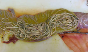 ascaris parasite