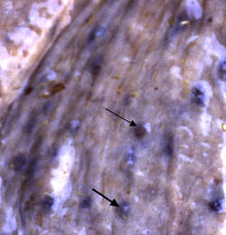 larves de cyathostomes