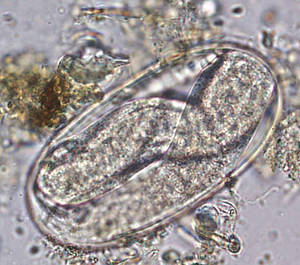 parasite oeuf de strongles